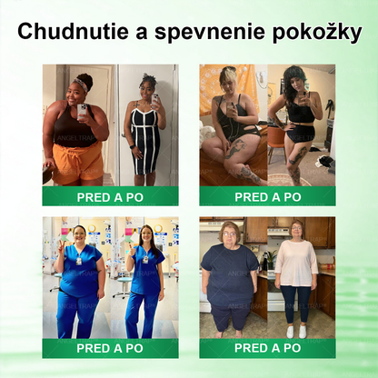 🌿𝐴𝑁𝐺𝐸𝐿𝑇𝑅𝐴𝑃® Moringa × Berberine × AMPK 10-in-1 Metabolic Support Nano Microneedle Patch 🇸🇰 (Na použitie iba raz denne, viditeľné zmeny už po 7 dňoch) ✅ Podporuje chudnutie, metabolické zdravie, spánkovú apnoe, problémy s kĺbmi a mnoho ďalších výhod.